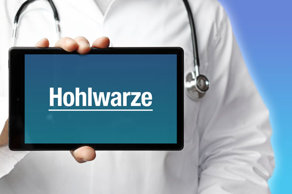 Schlupfwarzen Herne